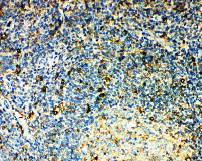 IHC - Anti-CCR3 Antibody ABO11486